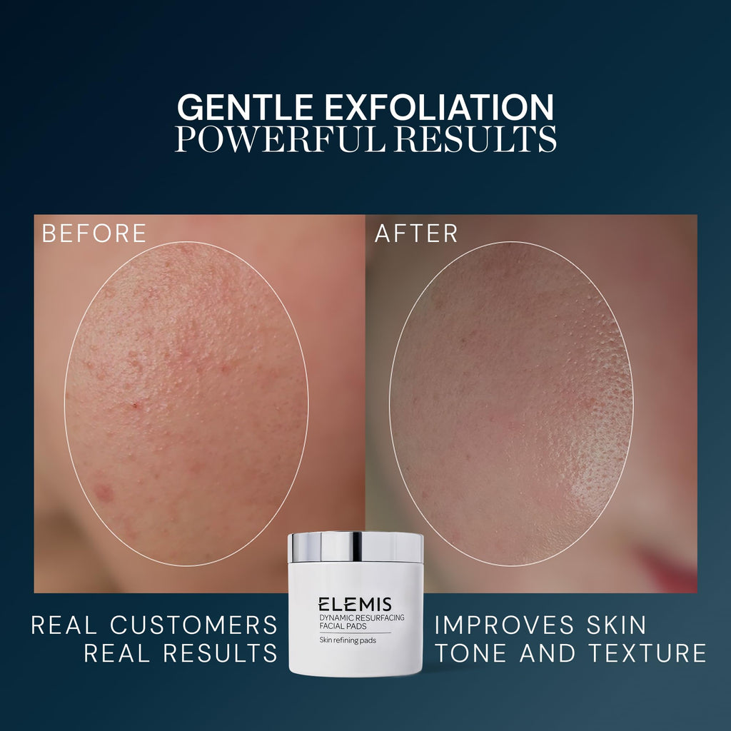 ELEMIS Dynamic Resurfacing Facial Pads, Gentle Textured Treatment Facial Exfoliating Pads