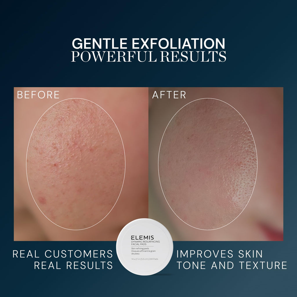 ELEMIS Dynamic Resurfacing Facial Pads, Gentle Textured Treatment Facial Exfoliating Pads